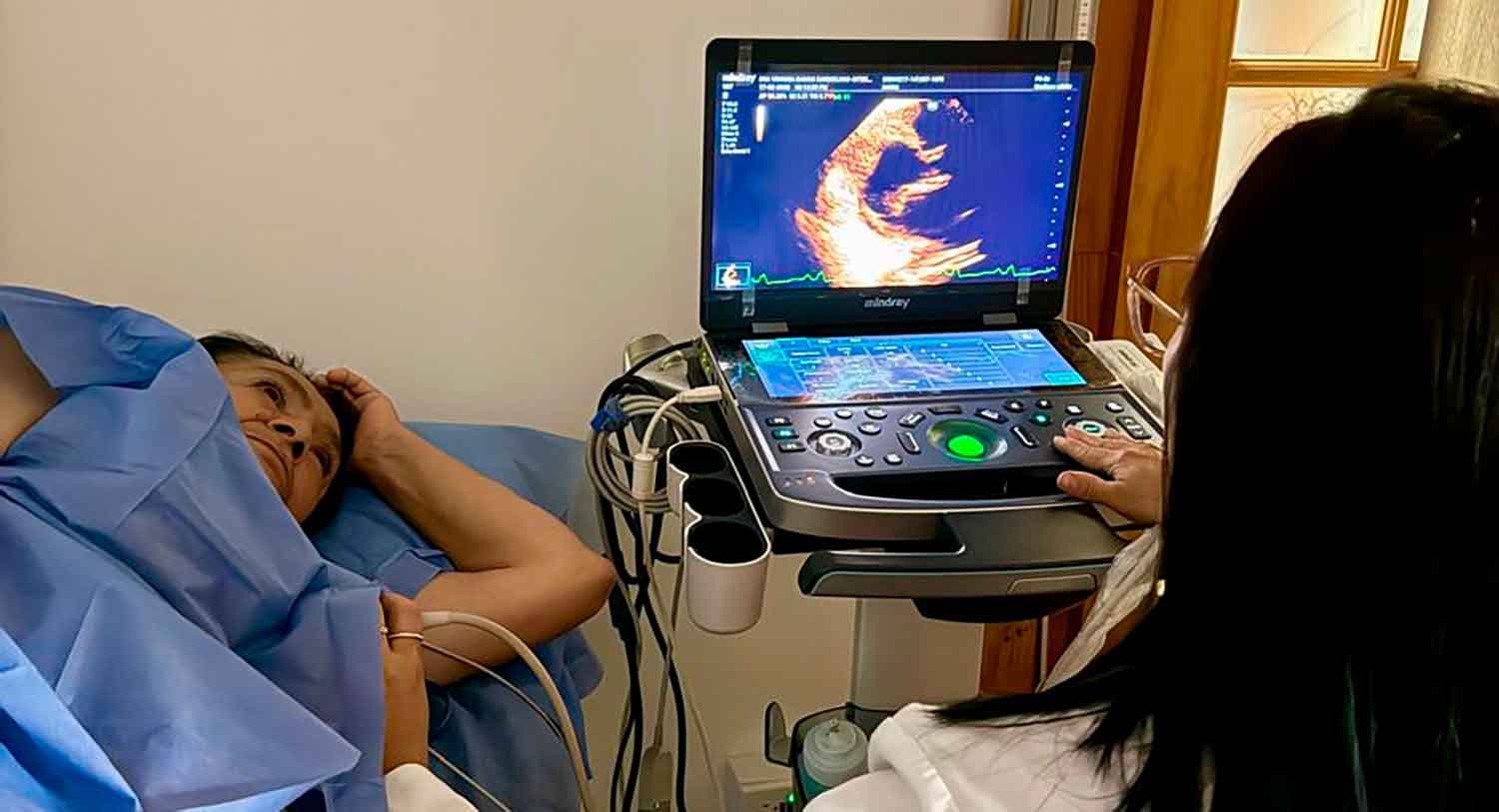Pantalla de ultrasonido mostrando ecocardiograma transtorácico en tiempo real en Medellín